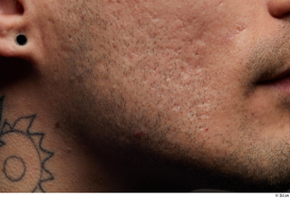 HD Face Skin Shawn Jacobs cheek chin face skin pores…